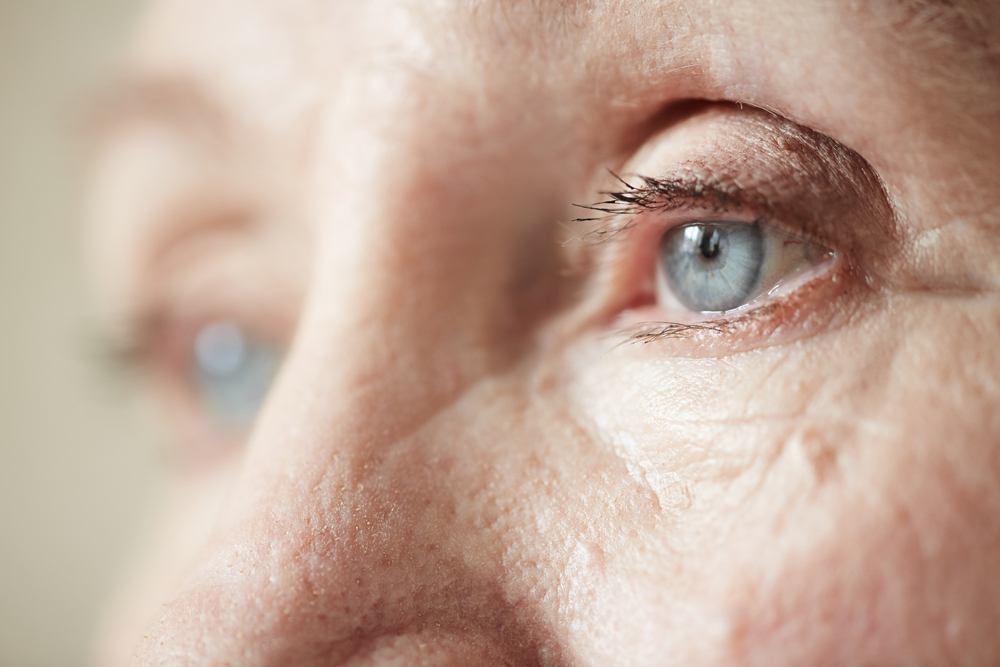 9 Strange Eye Symptoms You Should NEVER Ignore After 50 1