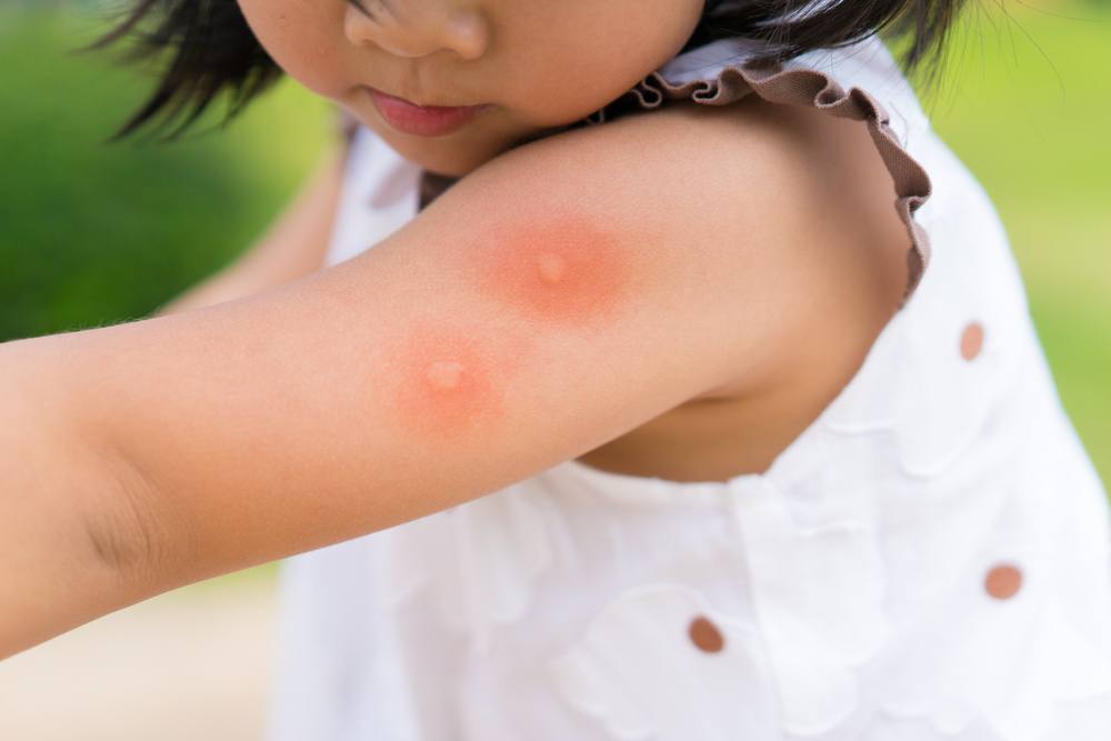 Top 10 Mosquito-Infested Cities in the U.S. (Are You in One of Them?) 1